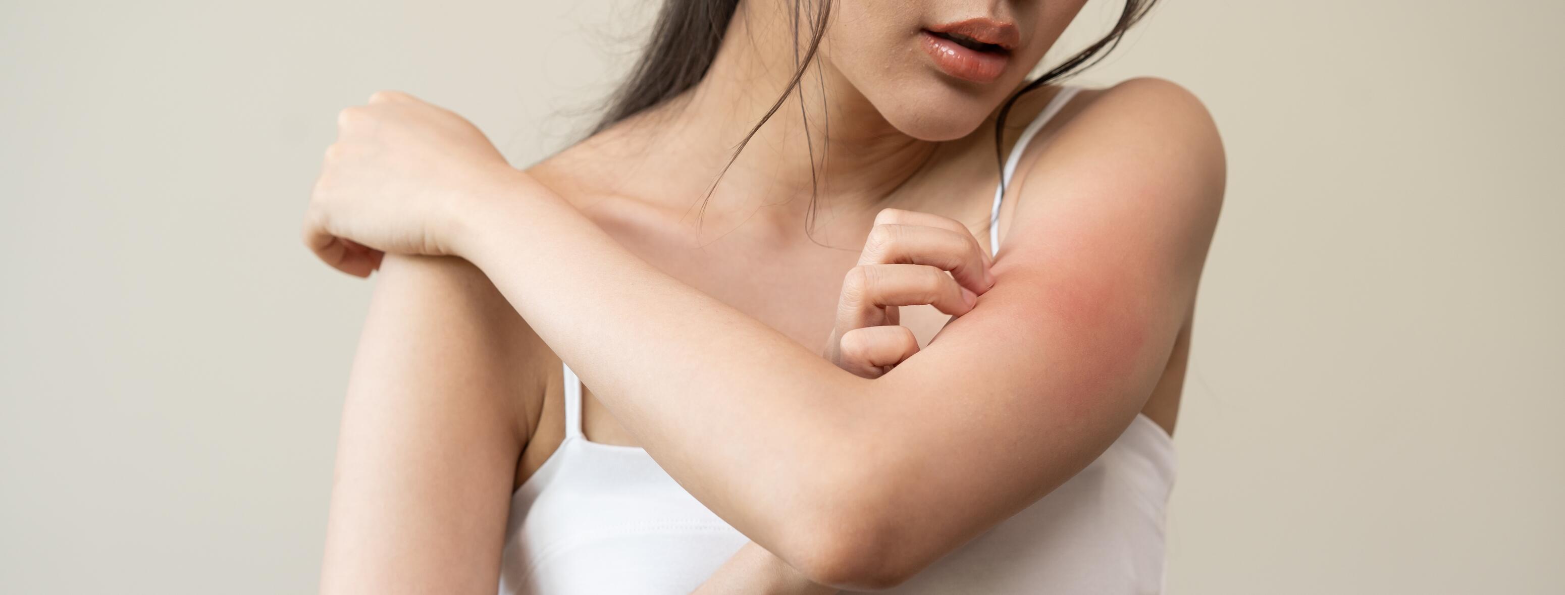 irritation zones sensibles